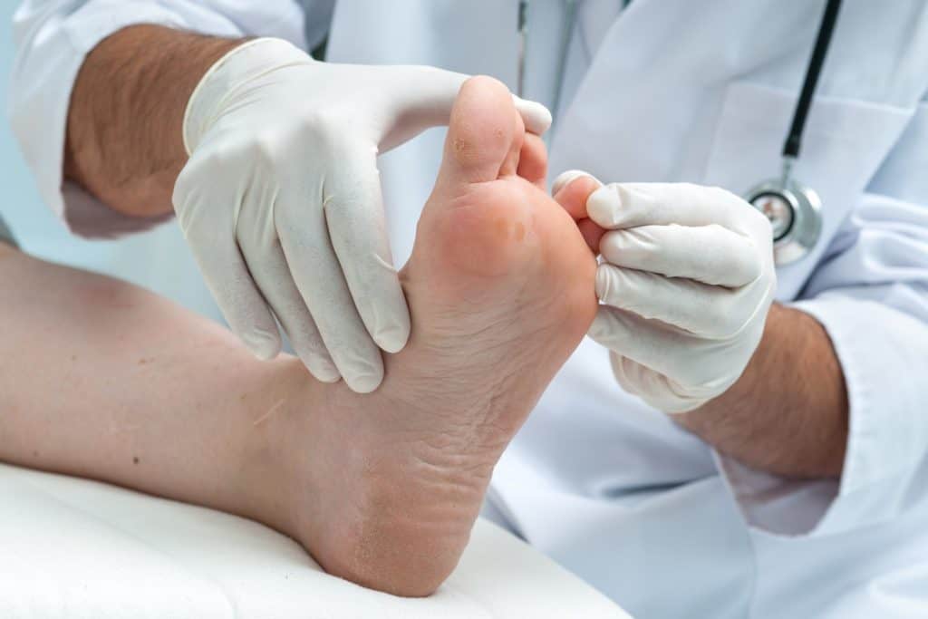 Comment traiter l'eczéma au niveau des pieds